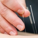 The Amazing Wellness Possibilities Of Acupressure