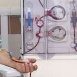 How You Can Reduce The Need For Dialysis Naturally