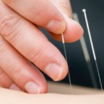 Could Chinese Medicine And Acupuncture Cure Your Knee Pain?