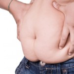 Does Your Weight Put You At Risk Of Hypercholesterolemia?