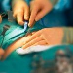 Obese People Have To Complete Plan Before Operations