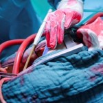 Could Heart Disease Patients Grow New Blood Vessels?