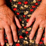 Hope for Arthritis Sufferers From Drug ‘Invisibility Cloak’