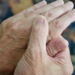What Do You Need to Know about Living with Arthritis?