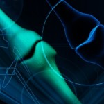 Could a Super Bone Graft Help Prevent Your Arthritic Pain?