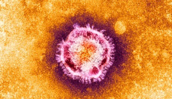 M055417-SARS_virus_342x198