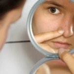 How Can Probiotics Help with Curing Acne?