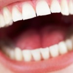 Warning: Poor Oral Health Could be Caused by Bad Diet