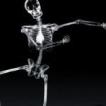Researchers Make Remarkable Bone Cancer Discovery